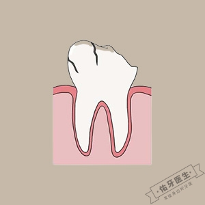 牙齿残冠残根别放弃