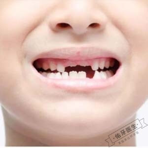 儿童恒牙缺失怎么办？