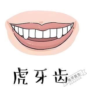 虎牙矫正哪种方法最适合你？