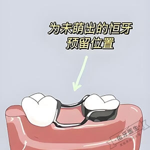 乳牙早失怎么办？