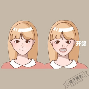 开颌怎么矫正？