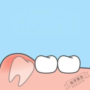 埋伏牙一定要拔吗？