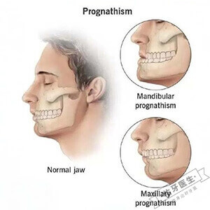 颌骨发育畸形logo图