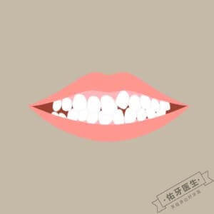 牙列拥挤logo图