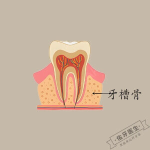 牙槽骨吸收logo图