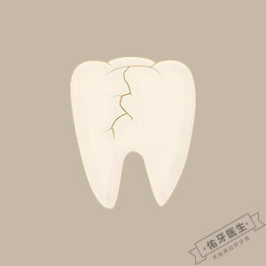 牙齿劈裂logo图