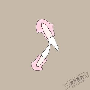 牙齿深覆盖怎么矫正？