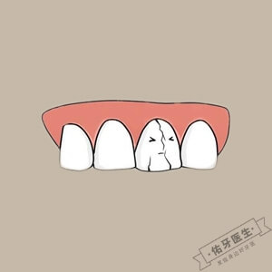 牙齿劈裂怎么办？