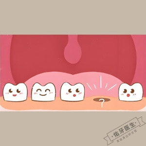 先天性缺牙怎么治疗？