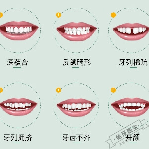 牙齿畸形怎么办？