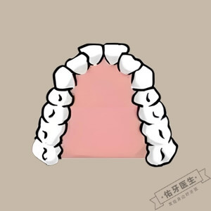 牙弓狭窄怎么矫正？