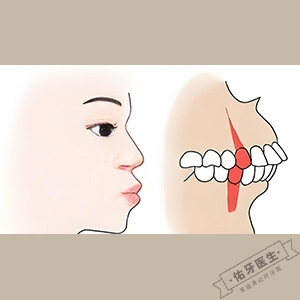 牙颌骨发育畸形怎么办？