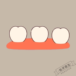 牙列稀疏怎么办？