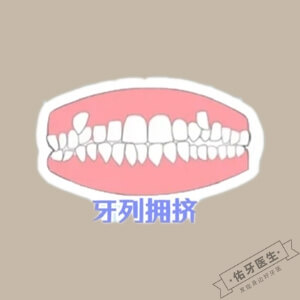 牙列拥挤怎么办？