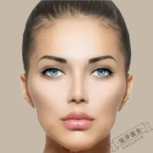 牙套脸是什么？