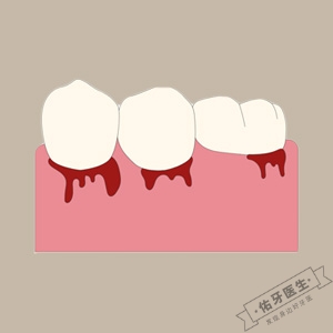 牙龈出血怎么办？