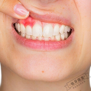 牙龈红肿怎么办？
