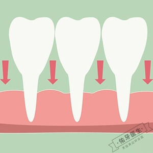 牙龈萎缩怎么治疗？