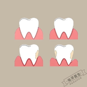 门牙牙龈萎缩怎么办？