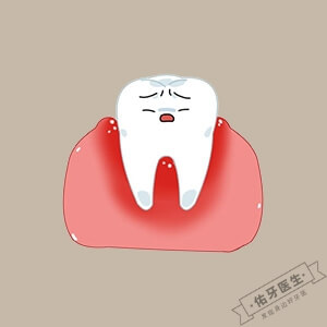 牙龈炎怎么治疗？