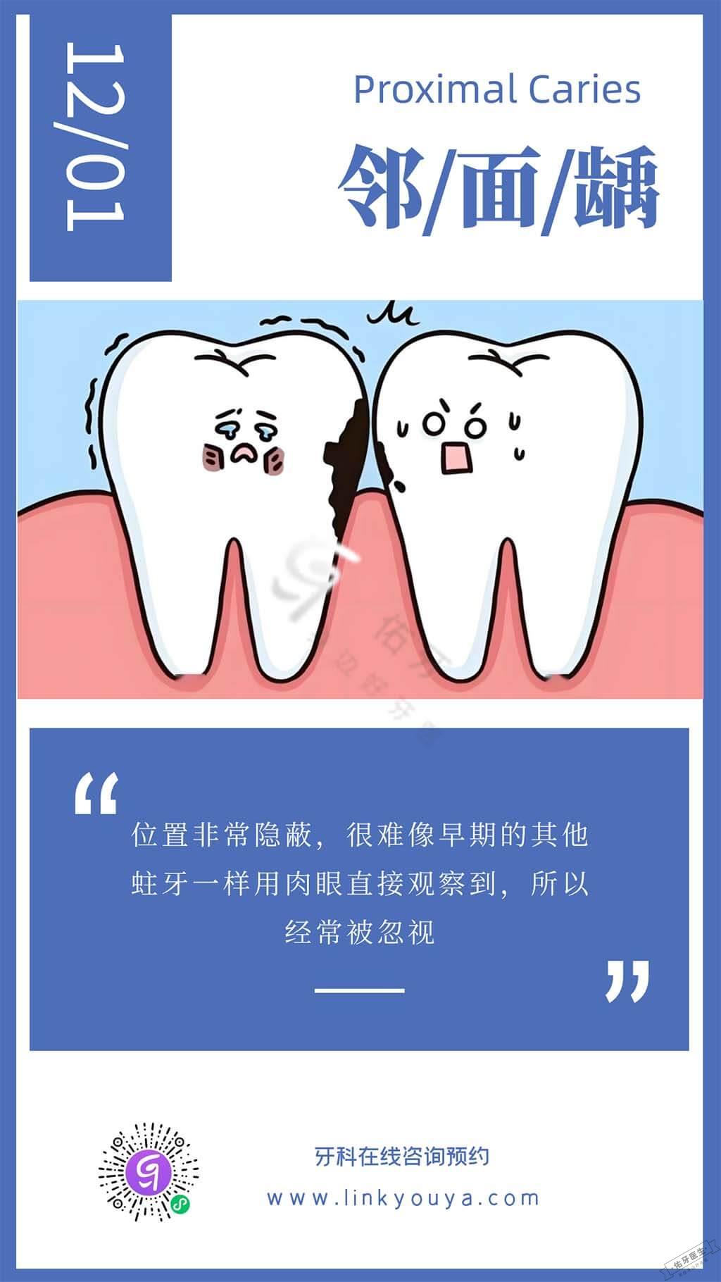 邻面龋早期症状与检查指南 - 佑牙医生