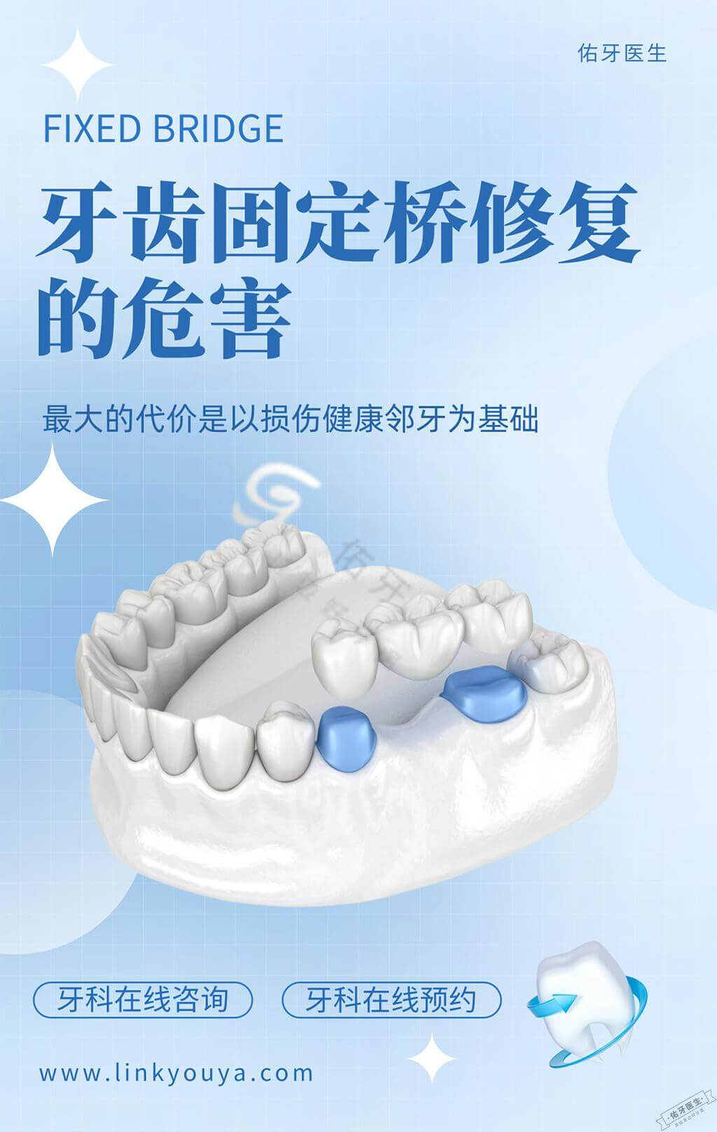 牙齿固定桥修复危害大吗? - 佑牙医生
