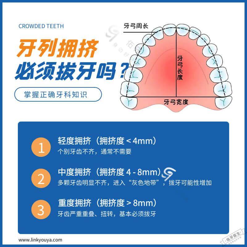 牙列拥挤度多少必须拔牙? - 佑牙医生