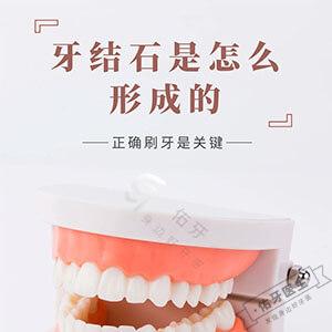 牙结石是怎么形成的？