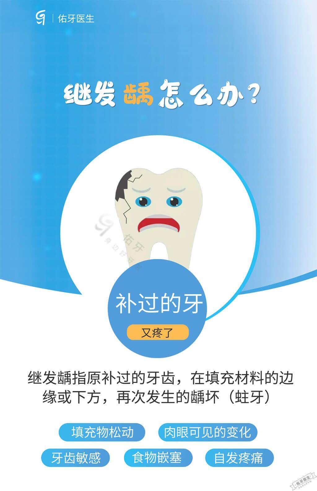 继发龋怎么办？别慌！一文读懂原因、症状与治疗修复方法- 佑牙医生