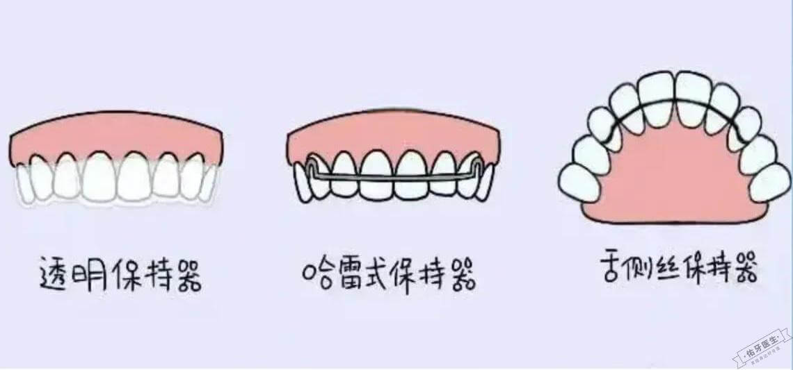 舌侧保持器:优缺点、佩戴时间及适用人群全解析 - 佑牙医生
