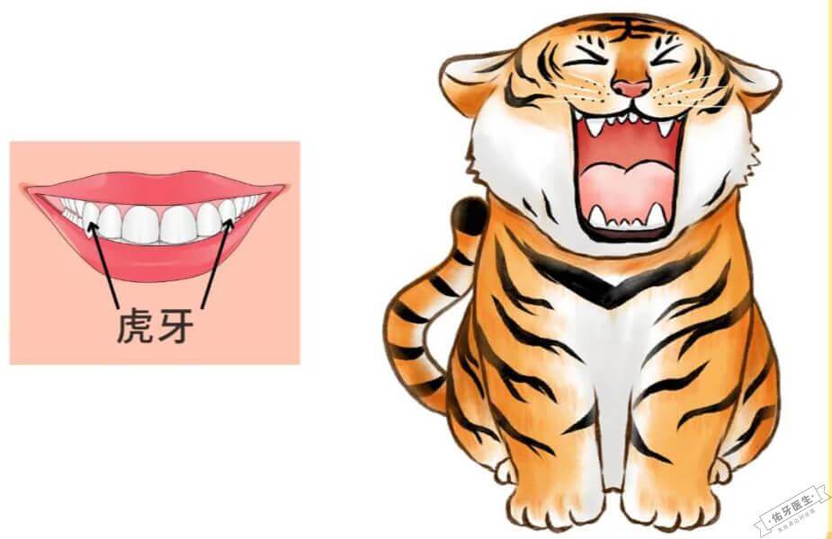 虎牙