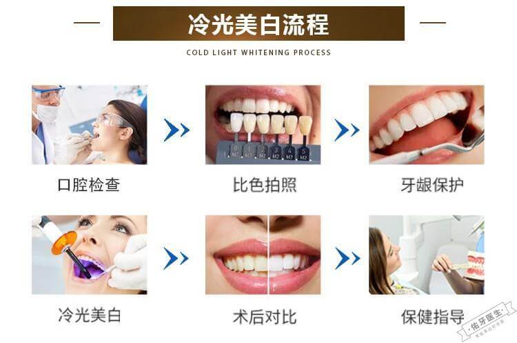 冷光美白流程图