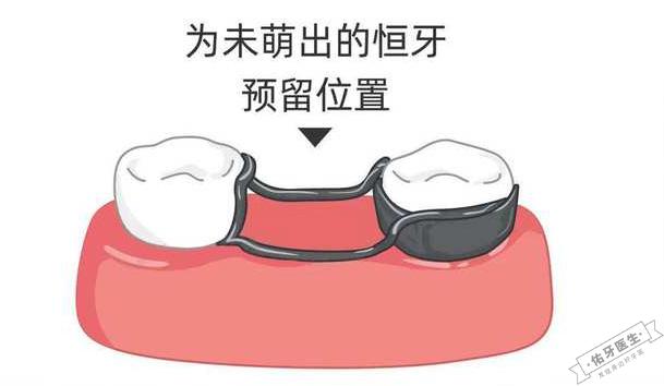 间隙保持器作用