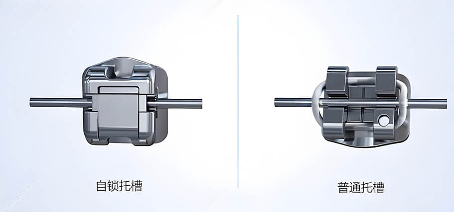 牙齿松动怎么办？