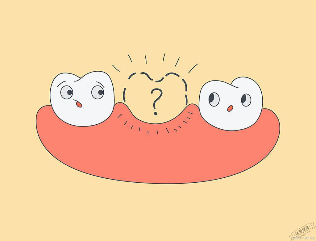 先天缺牙示意图