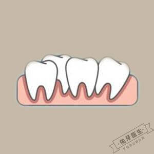 牙齿不齐1