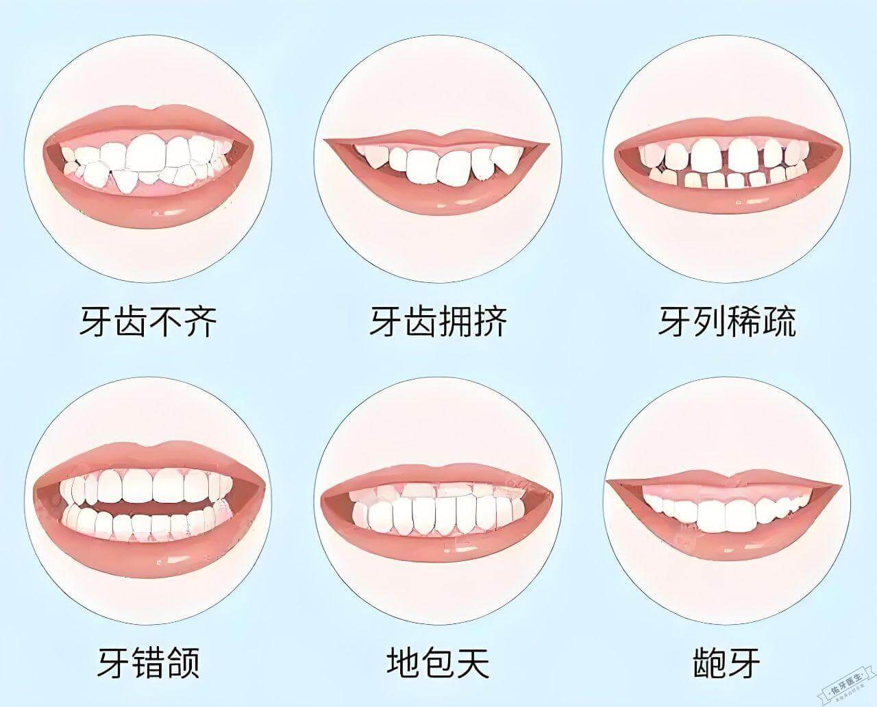 常见的牙齿畸形