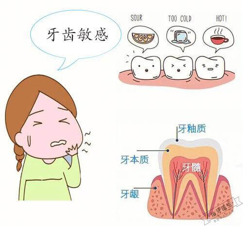 牙齿敏感