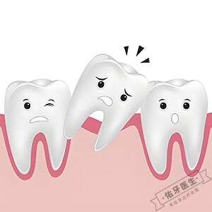 牙列不齐的原因、危害及科学矫正方法解析 - 佑牙医生