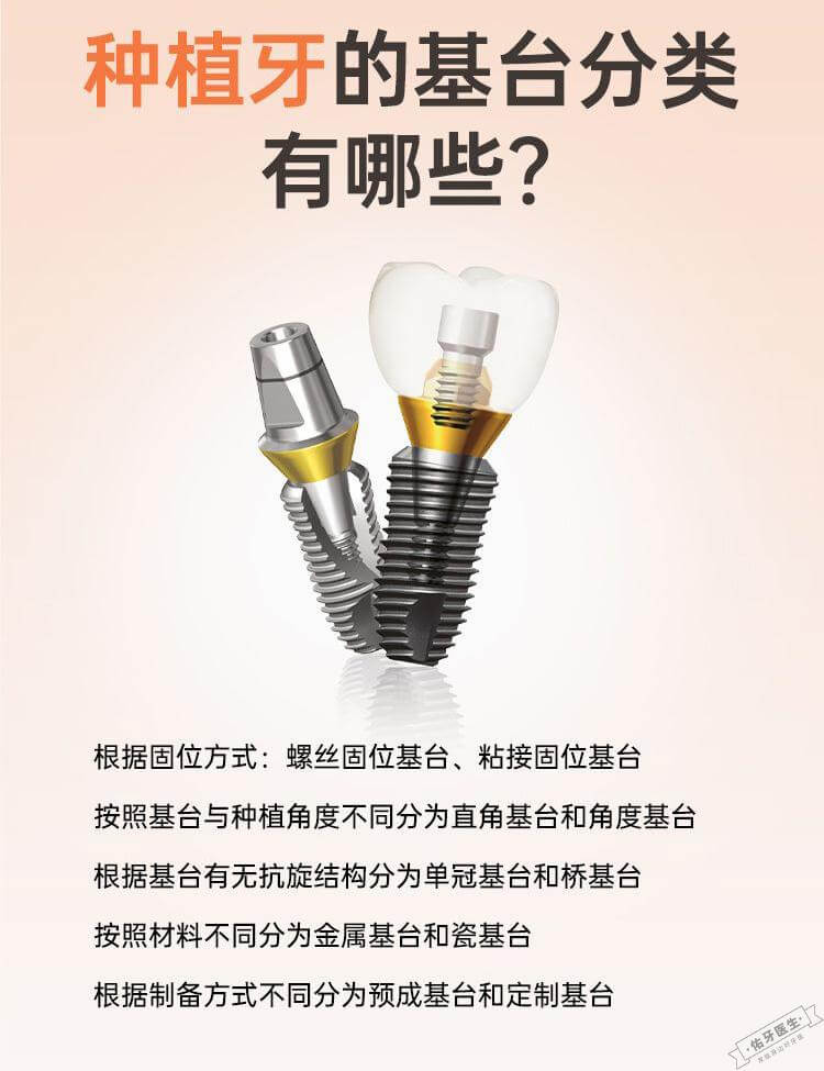 种植体基台分类指南:了解不同类型种植体配件的选择与应用 - 佑牙医生